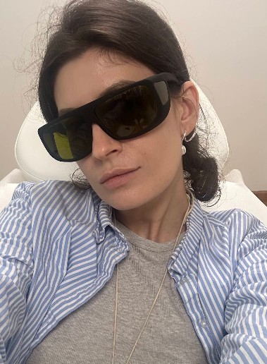 Laser Skin Rejuvenation New York